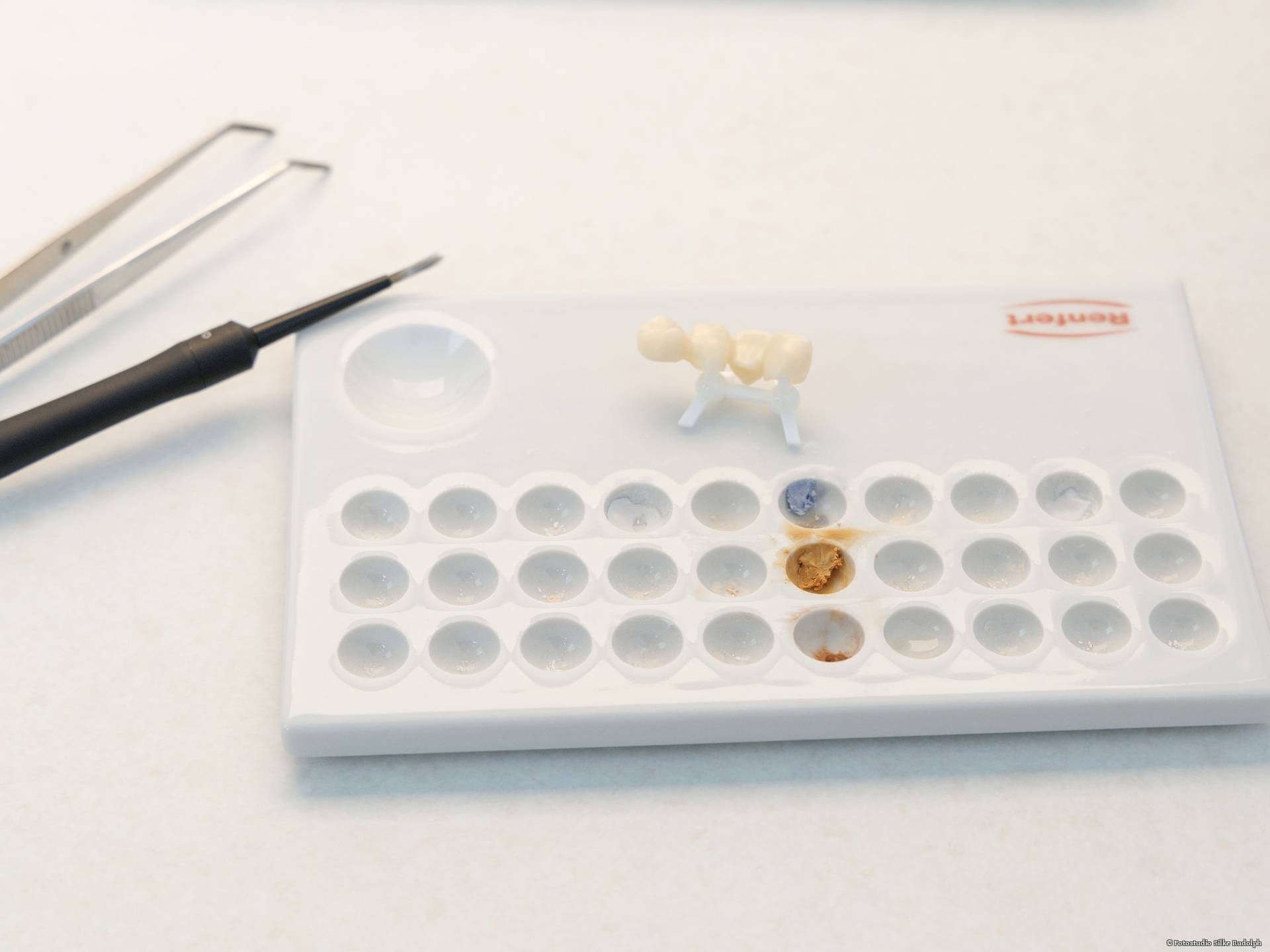 Aushärtung des Zahnersatzes im Brennofen